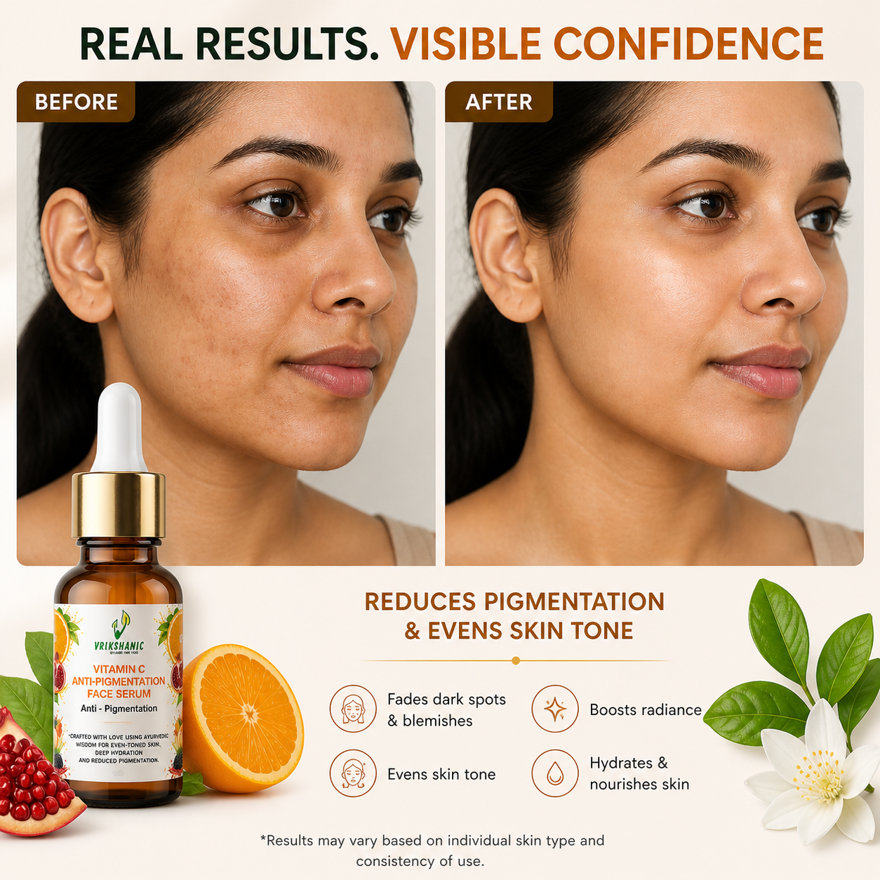 Vitamin C  Anti - Pigmentation Face Serum